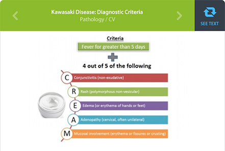 Medical Mnemonic for Kawasaki DIsease: Diagnostic Criteria Image | ABIM Board Exam Preparation Platform